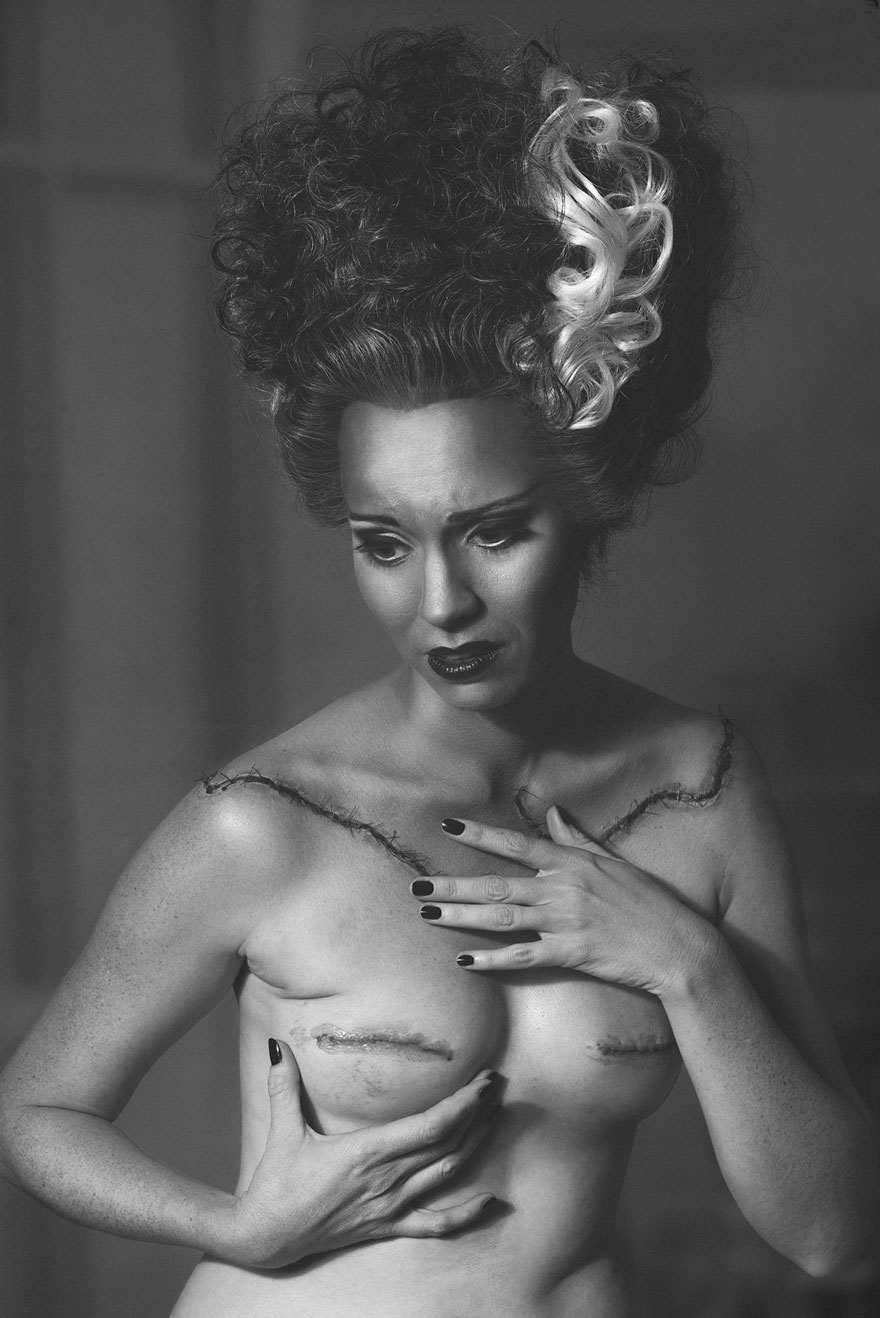 fotos-mastectomia-cancer-my-breast-choice-aniela-mcguinness (1)