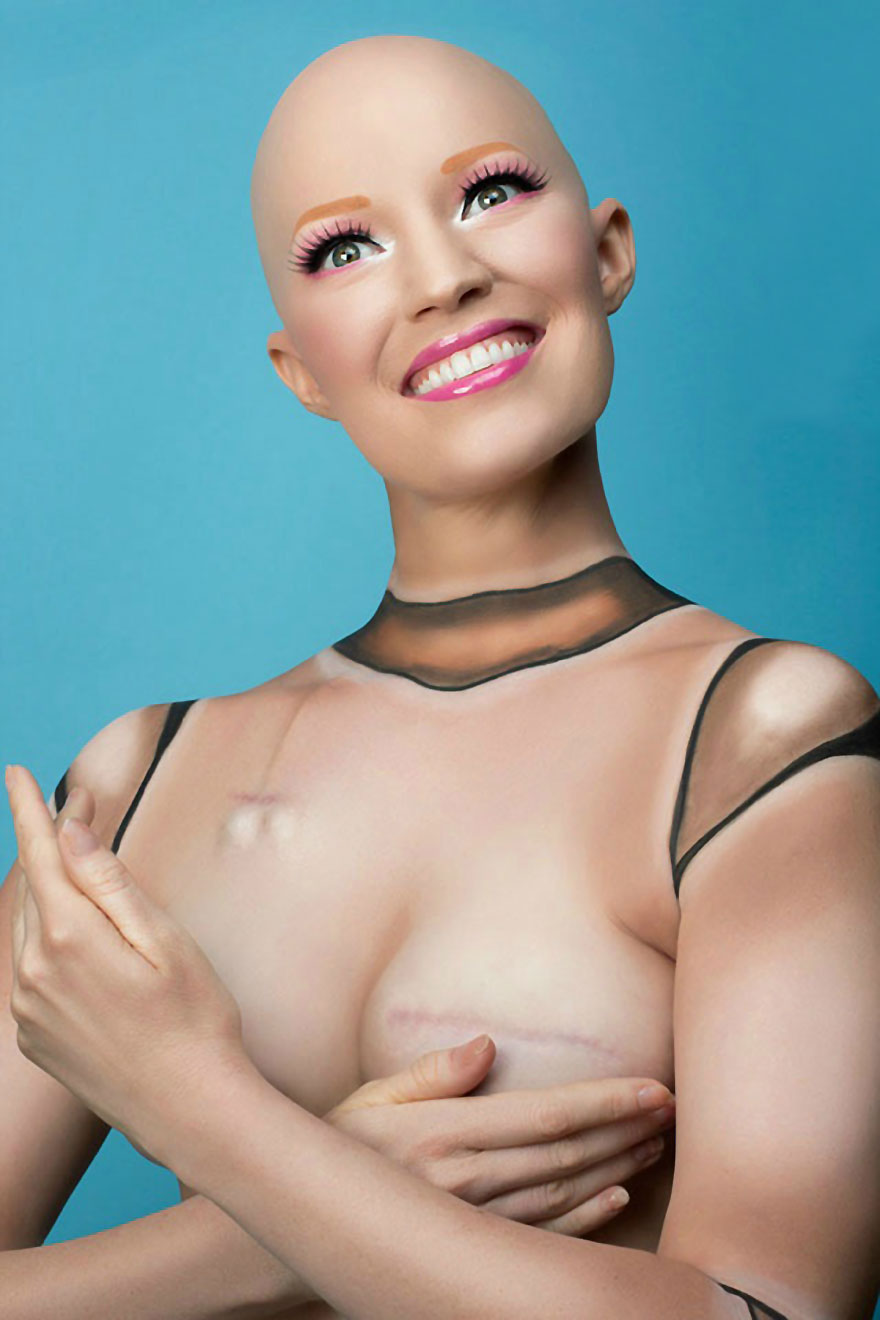 fotos-mastectomia-cancer-my-breast-choice-aniela-mcguinness (3)