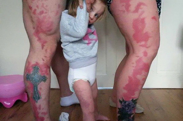 padres-tatuaje-marca-nacimiento-hija (4)