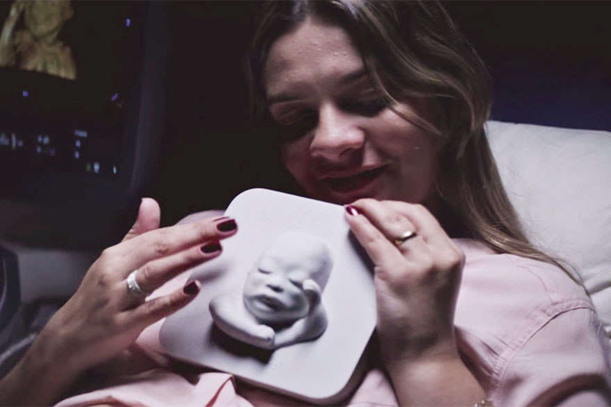 impresion-3d-feto-madre-ciega-huggies (4)