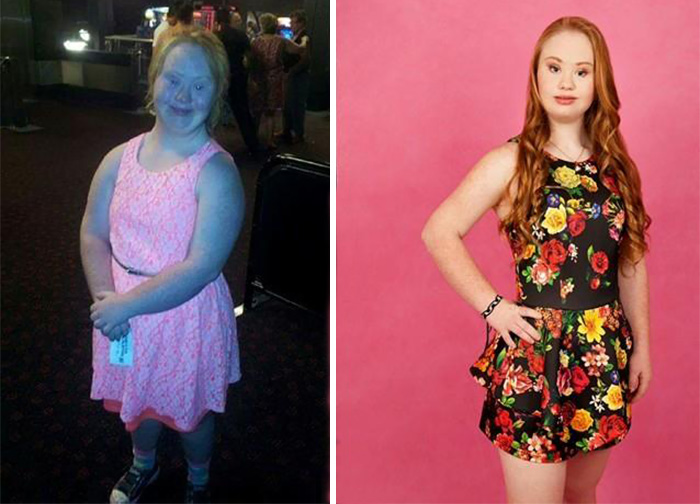 modelo-sindrome-down-madeline-stuart (9)