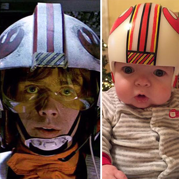 cascos-guerra-galaxias-craneosinostosis-bebe-jack (2)