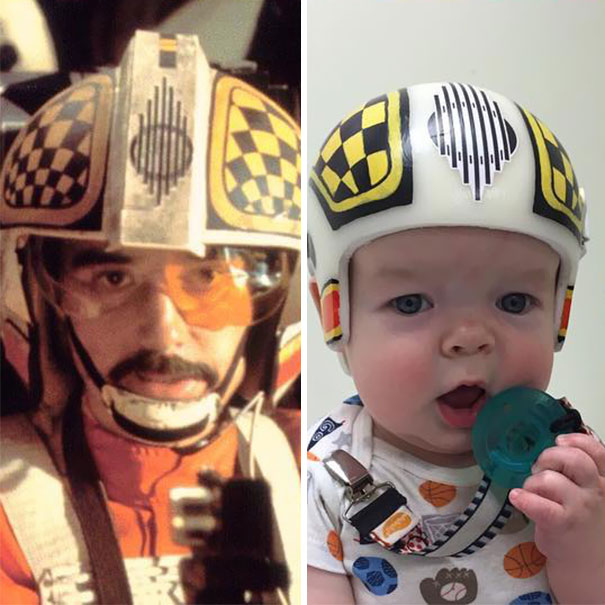 cascos-guerra-galaxias-craneosinostosis-bebe-jack (3)