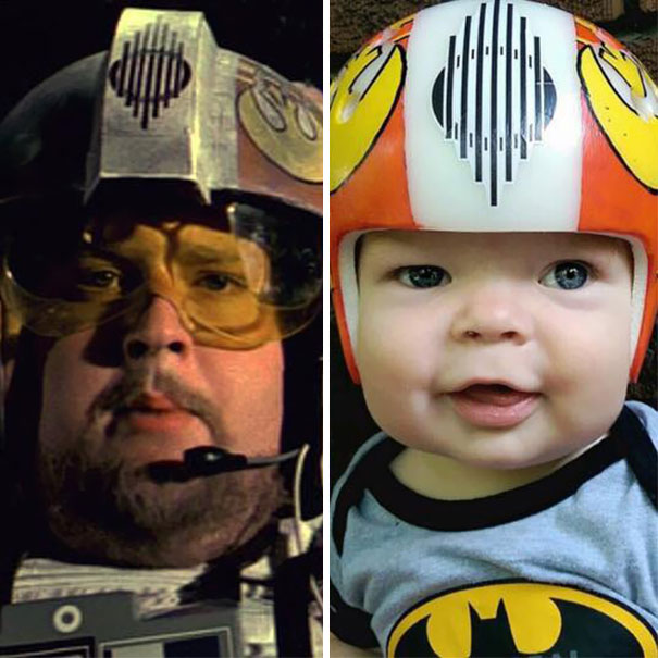 cascos-guerra-galaxias-craneosinostosis-bebe-jack (4)