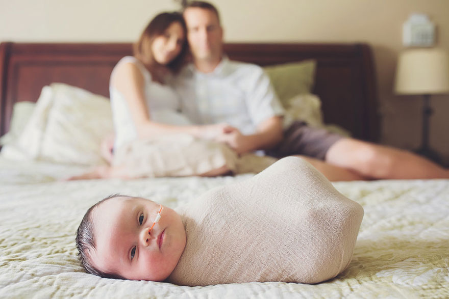 fotos-familiares-bebe-tumor-cerebral-abigail-jones (1)