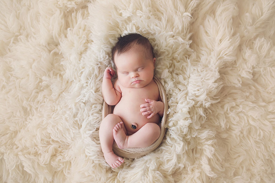 fotos-familiares-bebe-tumor-cerebral-abigail-jones (11)