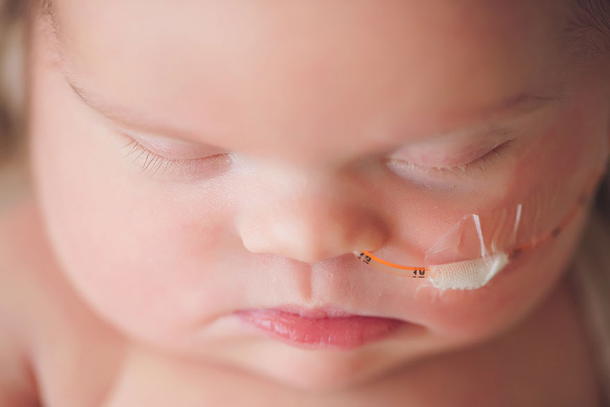 fotos-familiares-bebe-tumor-cerebral-abigail-jones (13)