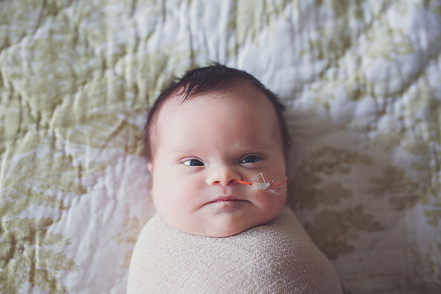fotos-familiares-bebe-tumor-cerebral-abigail-jones (4)
