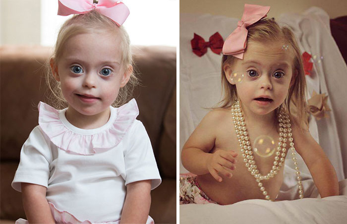Esta niña de 2 años con síndrome de Down consigue un contrato de modelo gracias a su encantadora sonrisa