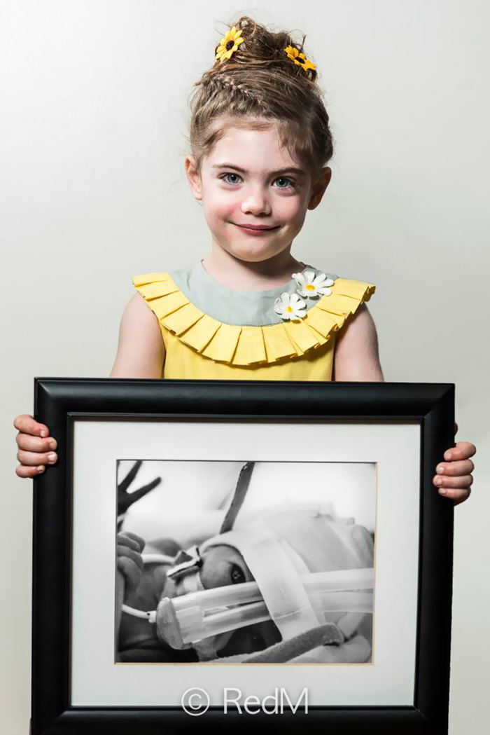 retratos-bebes-prematuros-les-premas-red-methot (9)