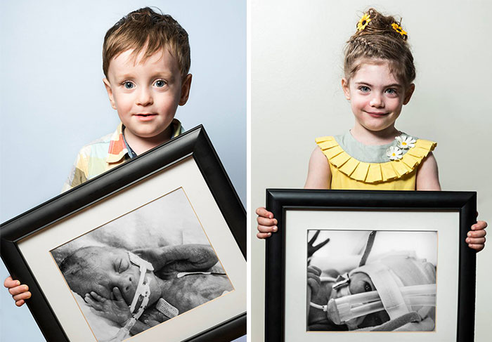 Elocuentes retratos del antes y después de bebés prematuros