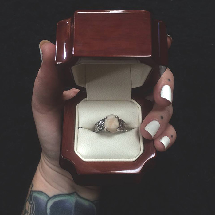 anillo-compromiso-muela-juicio-carlee-leifkes-lucas-unger (7)
