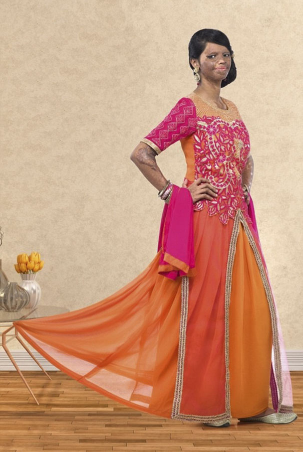 laxmi-superviviente-ataque-acido-modelo-india (1)