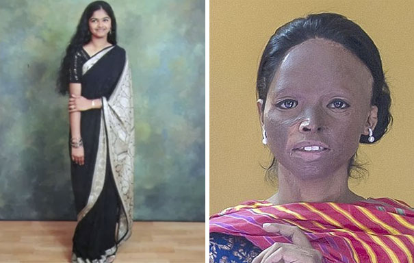 laxmi-superviviente-ataque-acido-modelo-india (8)