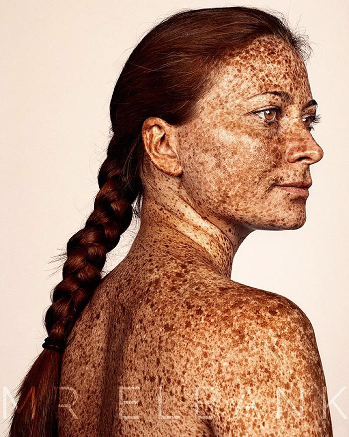retratos-personas-pecosas-brock-elbank (1)
