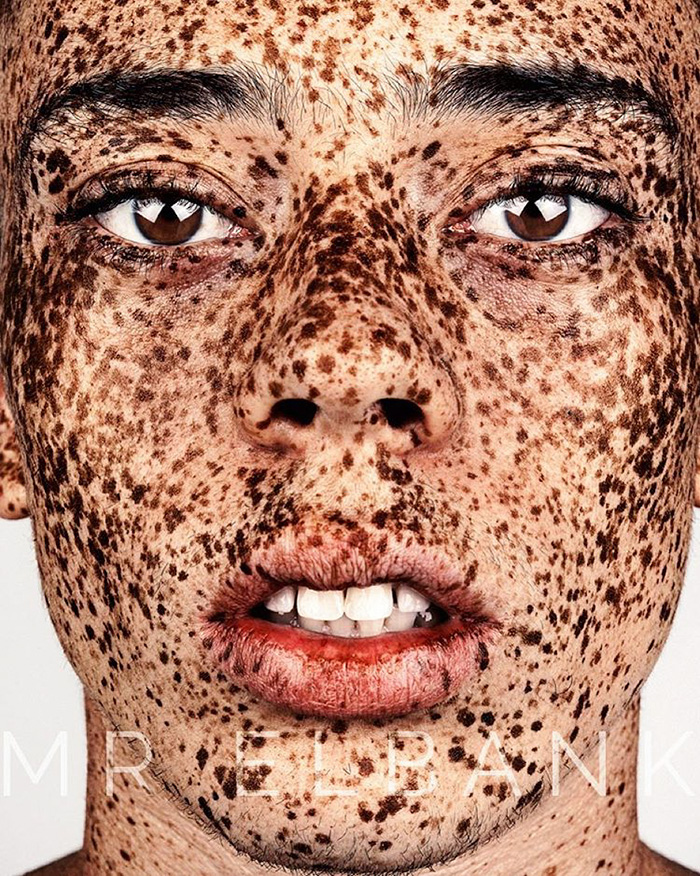 retratos-personas-pecosas-brock-elbank (14)