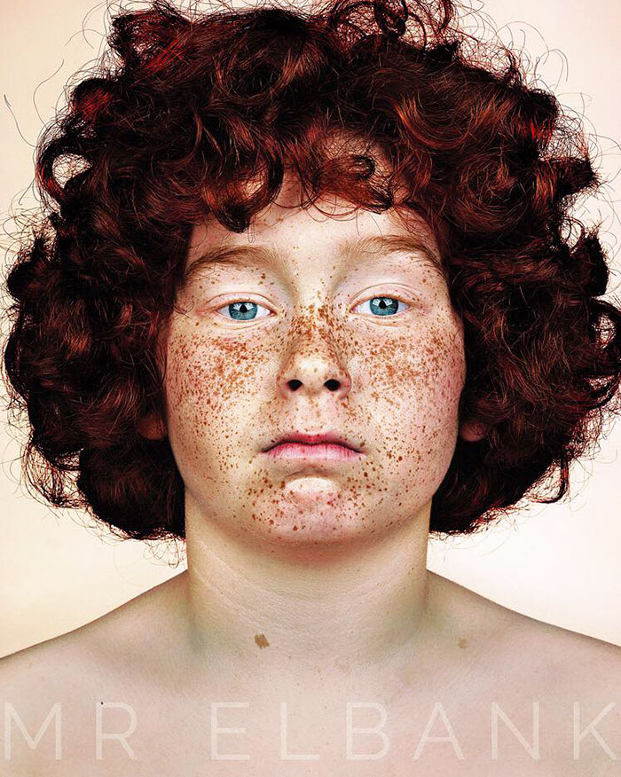 retratos-personas-pecosas-brock-elbank (7)
