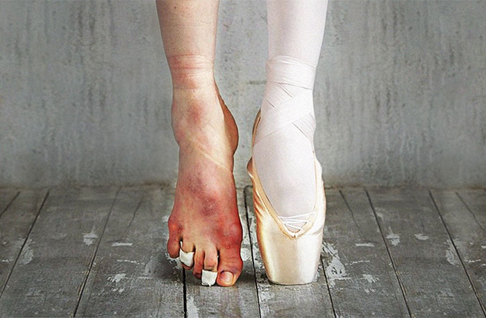 fotos-bailarinas-dia-ballet (6)
