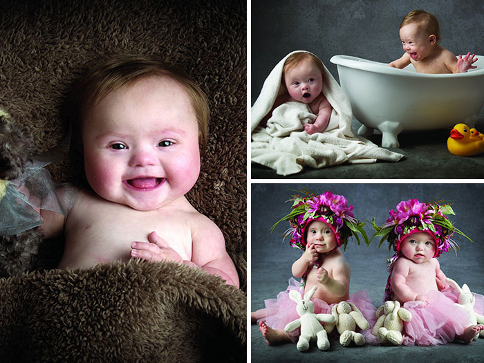 Estos bebés con síndrome de Down posan para una adorable sesión de fotos benéfica