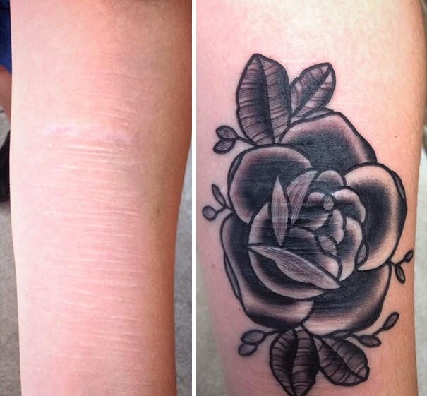 tatuajes-gratis-cubrir-cicatrices-violencia-autolesiones-brian-finn (2)