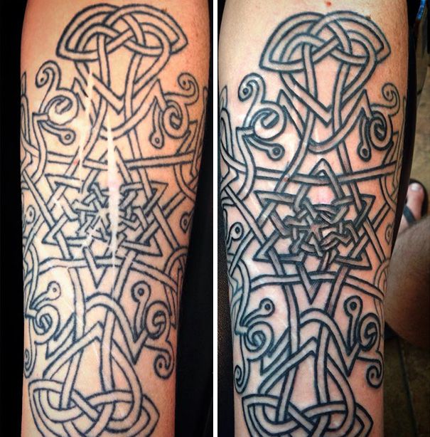 tatuajes-gratis-cubrir-cicatrices-violencia-autolesiones-brian-finn (3)