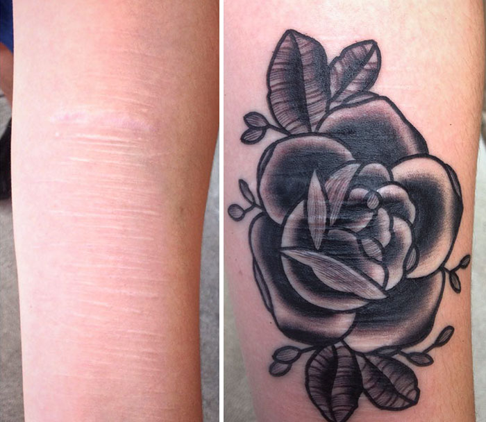 Este tatuador ofrece tatuajes gratis para cubrir cicatrices a supervivientes de violencia doméstica, tráfico humano y autolesiones
