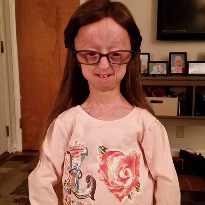 amistad-nina-progeria-lindsay-rattclife-levantador-pesas-david-douglas (1)