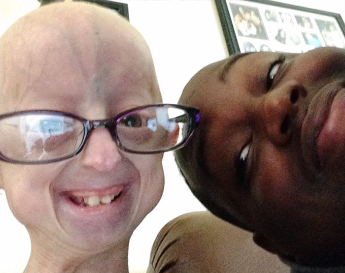 amistad-nina-progeria-lindsay-rattclife-levantador-pesas-david-douglas (4)