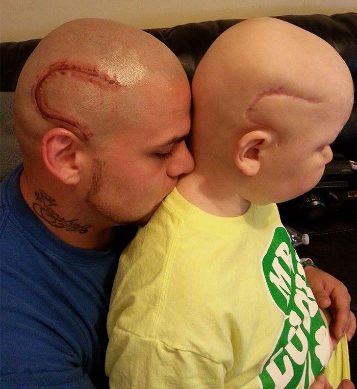 Este padre se tatúa en su propia cabeza la cicatriz tras el cáncer de su hijo para aumentar su autoconfianza