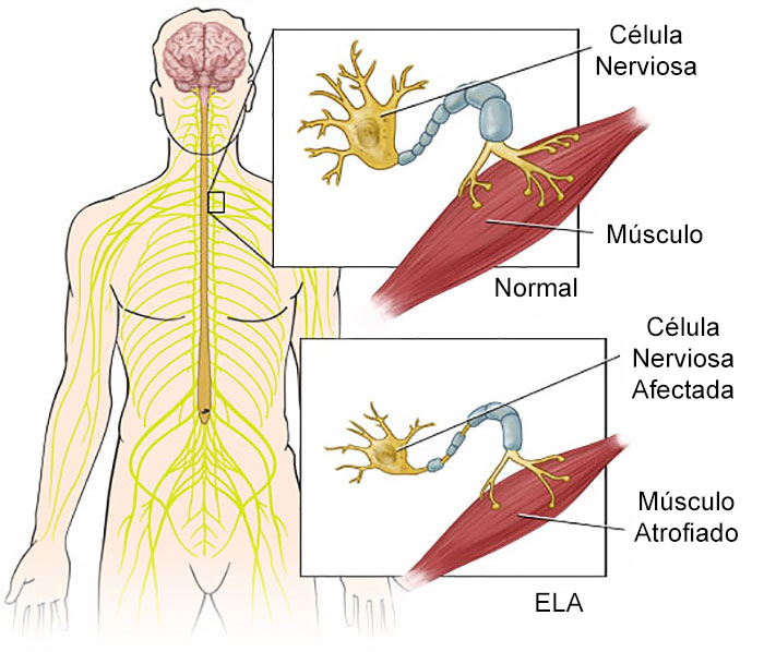 avance-investigacion-ela-gracias-reto-cubo-agua-helada-(4)