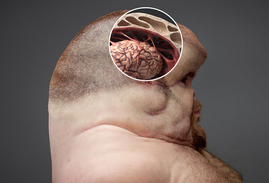 graham-cuerpo-que-sobrevive-un-accidente-vial-seguridad-patricia-piccinini (6)