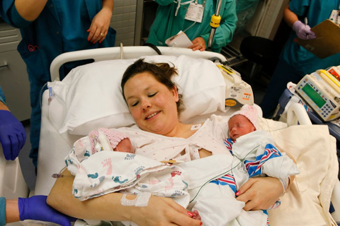 gemelas-monoamnioticas-dandose-mano-jenna-jillian-thistlethwaite (5)