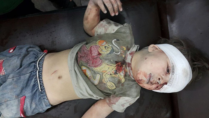 nino-superviviente-ataque-aereo-siria-omran-daqneesh (1)