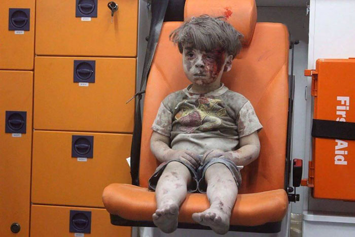 nino-superviviente-ataque-aereo-siria-omran-daqneesh (2)