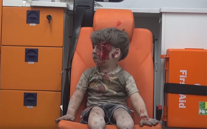 nino-superviviente-ataque-aereo-siria-omran-daqneesh (4)