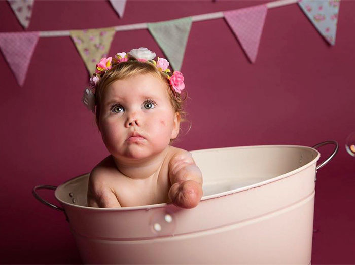 regalo-muneca-nina-amputada-harmonie (1)