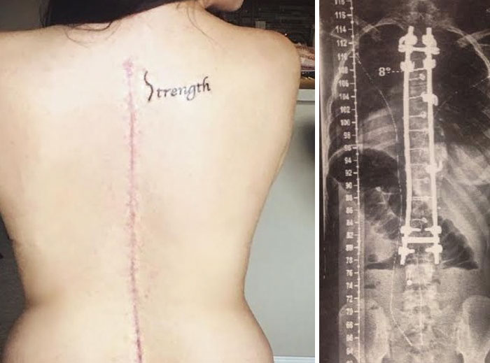 historias-tatuajes-cubriendo-cicatrices (4)