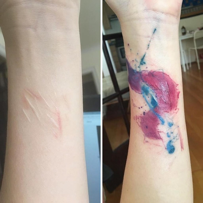 historias-tatuajes-cubriendo-cicatrices (8)