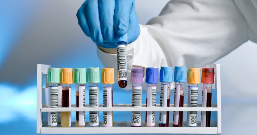 Aprendiendo Sobre Ets Aprendiendo Sobre Ets