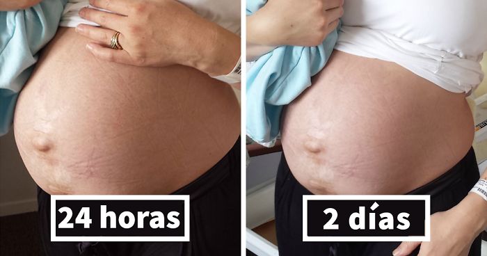 Mi verdadero cuerpo postparto: Quiero que todas las madres sepan que es normal y que son hermosas