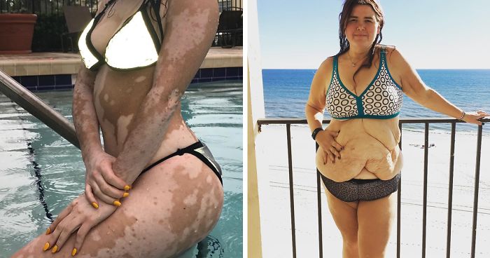 Estas 10+ mujeres ignoraron el bodyshaming y demostraron que todos los cuerpos son cuerpos de bikini
