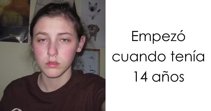 Una Joven Toma Fotos A Diario Por 8 Años Y Muestra Cómo Los Cambios Sutiles Crean Una Gran Diferencia Al Final