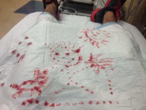 Mi Novio Se Ha Aplastado Y Fracturado Un Dedo, Y Así Ha Pasado El Rato En Urgencias