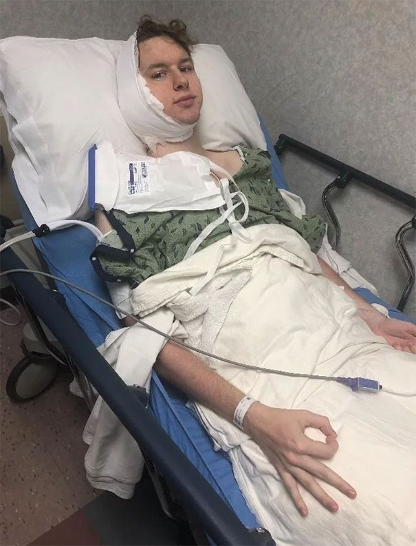 A Mi Hermano Le Acaban De Quitar Un Tumor De La Glándula Salival. Esta Es Su 1ª Foto Tras La Operación