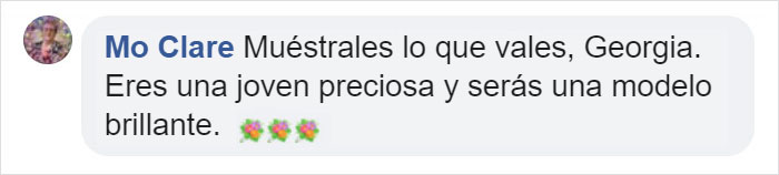 Te presentamos una modelo adolescente con el síndrome de Down que tiene 50 mil seguidores en su Instagram