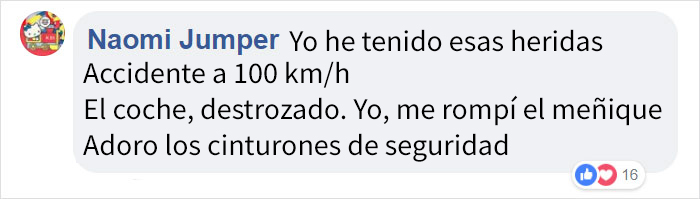 10 Supervivientes de accidentes de coche posan orgullosos para un proyecto fotográfico sobre la importancia del cinturón de seguridad