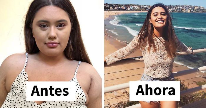 Esta mujer revela sus fotos antes y después de perder 64 kilos y no oculta nada