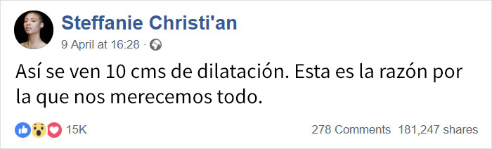 Esta "tabla de dilatación" ayuda a entender que dar a luz no es solo doloroso, es muy hardcore