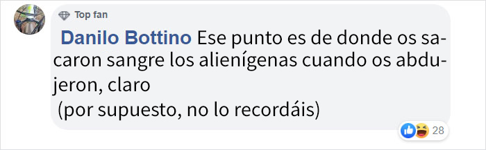 Alguien afirma que todas las mujeres tienen una peca en mitad de la muñeca, y la gente comienza a alucinar