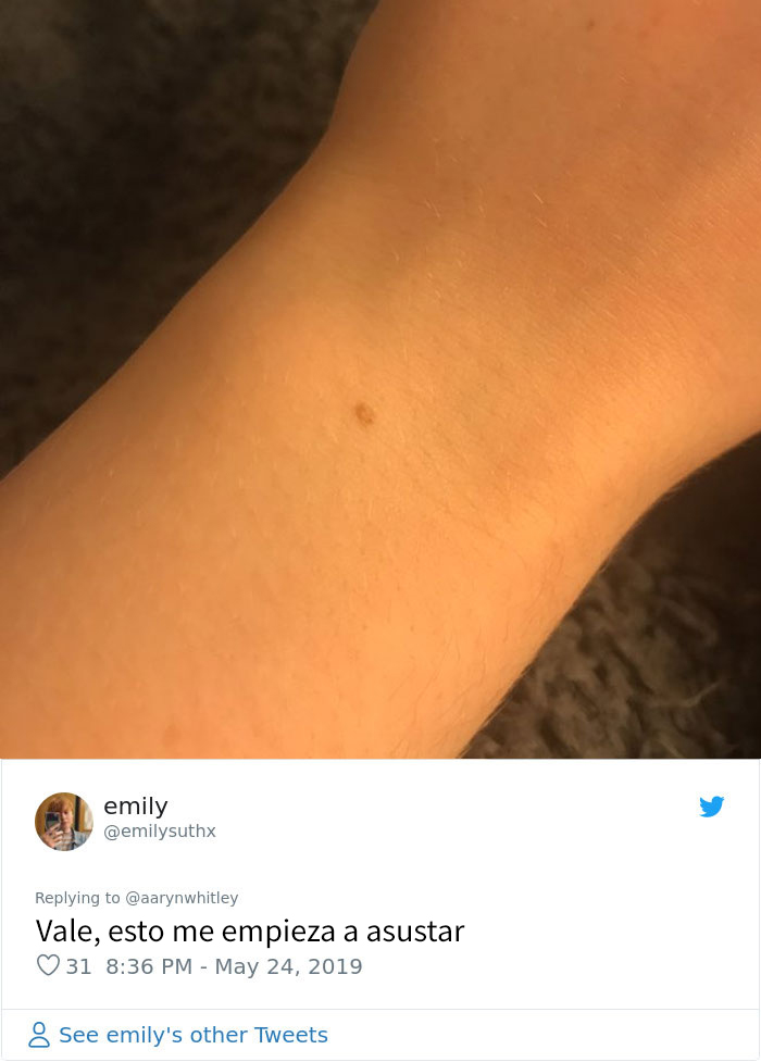 Alguien afirma que todas las mujeres tienen una peca en mitad de la muñeca, y la gente comienza a alucinar